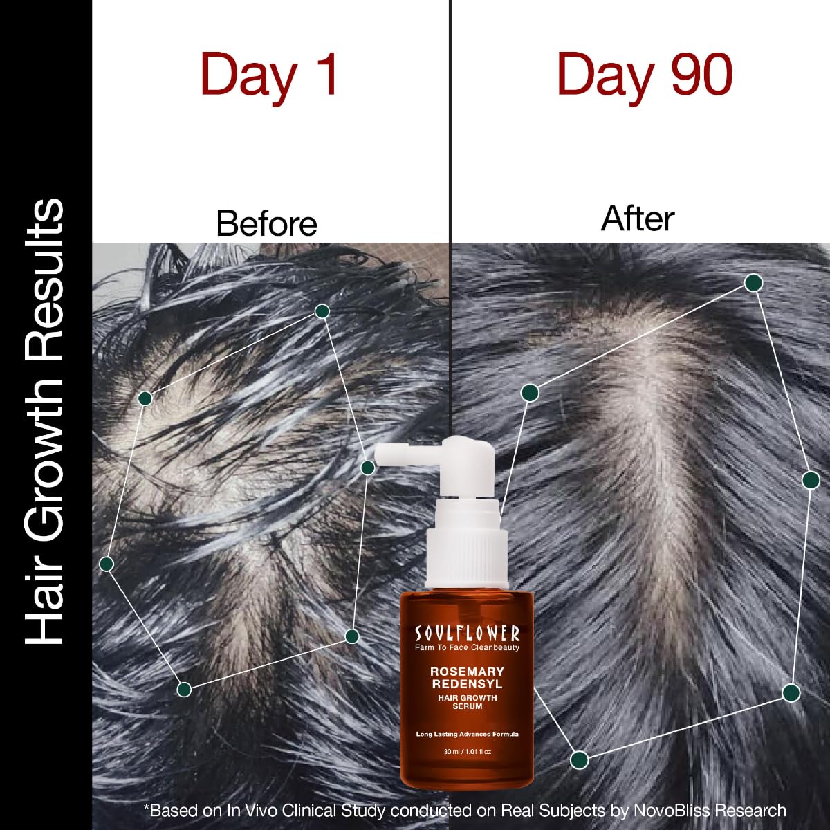 Soulflower Hair Growth Serum, Rosemary Oil, 3% Redensyl, 4% Anagain, Caffeine, Melanogray, Biotin, Rice Water, Clinically Tested on Real people, Hair growth & Hair fall control for Women & Men | 30ml - Image 5