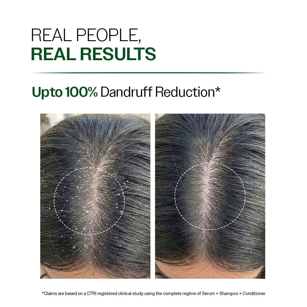 Bare Anatomy Anti-Dandruff Shampoo | Up To 100% Dandruff Reduction | ZPTO-Free | pH 5.3 | Salicylic Acid, Piroctone Olamine & Biotin | Non-Drying Formula | For Strong, Smooth Hair | Unisex | 100 ml - Image 5